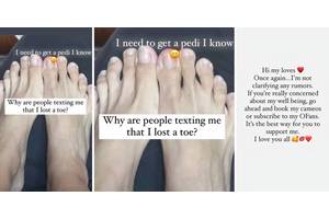 90 Day Fiancé: Jasmine Pineda Reveals What Happened To Her Toes Amid Rumors Of New Boyfriend Being Allegedly Abusive