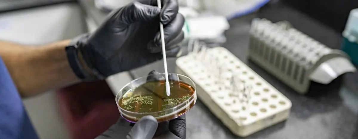 A scientist in Venezuela investigates antimicrobial resistance (AMR), considered one of the top 10 global public health threats, which occurs when viruses change over time and no longer respond to medicines. A scientist in Venezuela investigates antimicrobial resistance (AMR), considered one of the top 10 global public health threats, which occurs when viruses change over time and no longer respond to medicines.