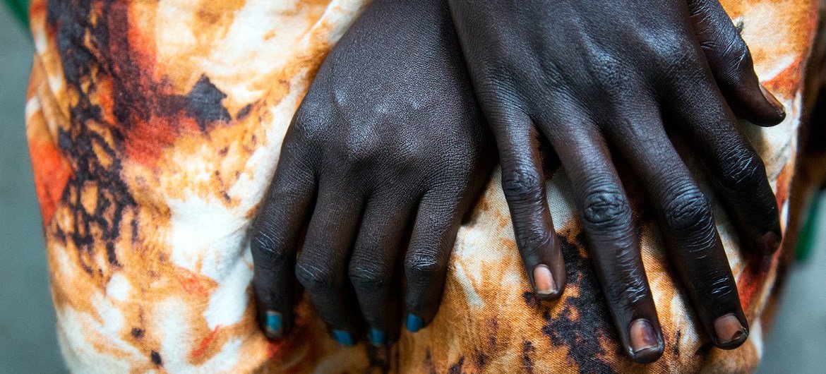 A South-Sudanese woman who was beaten by her husband seeks refuge in her brother’s house. A South-Sudanese woman who was beaten by her husband seeks refuge in her brother’s house.