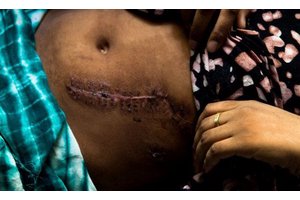 Call to action: Prevent gender
