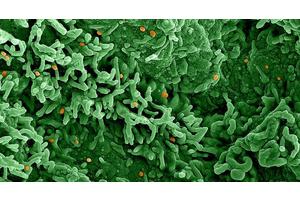 WHO chief convenes expert meeting on mpox spread | UN News