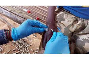 WHO approves first mpox diagnostic test for emergency use | UN News