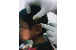 Indonesian doctors act on tell