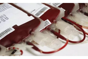 Why this kolaveri di? 3 nurses suspended for making reels in Hospital OT