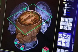 Brain tissue grown on semiconductor chip could lead to neural prosthetics
