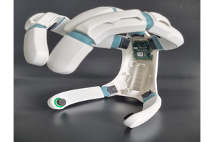u-blox technology deployed in Exsurgo’s Axon headset for chronic pain treatment