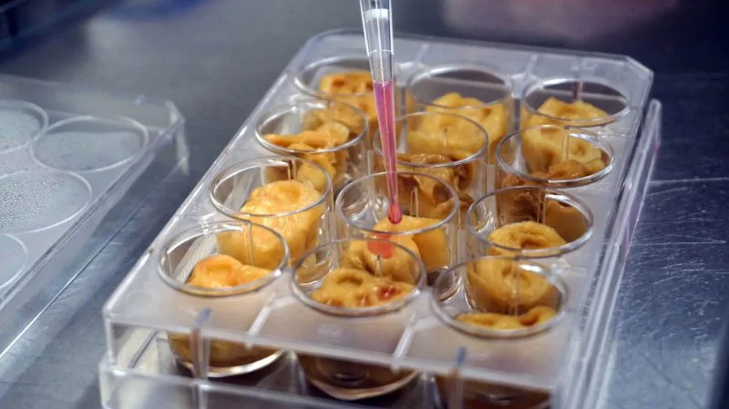 Human cells grown as an art project related to cell based food. Similarly, insect based alternative proteins have been lambasted. Credit: Ourochef