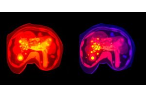 Advancing Fluorescence-Guided Surgery for Hepatocellular Carcinoma: Bridging Clinical Practice and Laboratory Research