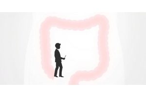 Predictive Potential of Lipids in Colorectal Cancer Treatment Outcomes