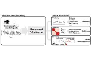 Revolutionizing Glucose Monitoring: A Pretrained Transformer Model for Decoding Individual Glucose Dynamics from Continuous Data
