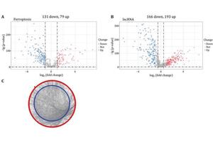 New Prognostic Model for Acute Myeloid Leukemia Leverages Ferroptosis-Related lncRNA and Immune Infiltration Insights