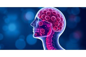 Chemo-Immunotherapy Exhibits Promising Efficacy in Advanced HPV-Negative Head and Neck Cancer Patients