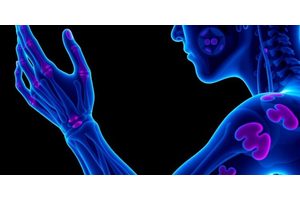 New Insights Uncover Why Scleroderma Primarily Affects Women and Explore Treatment Options