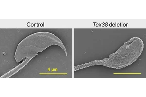 Revealing the Essential Protein Complex for Male Fertility