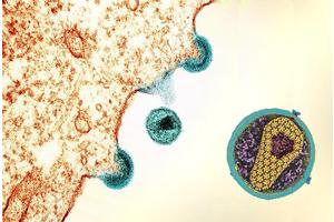 Promising New Therapy Shows Potential for Effective HIV Control in Uganda