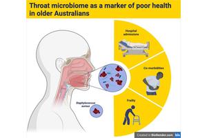 Exploring the Throat Microbiome: Insights into the Health of Older Australians