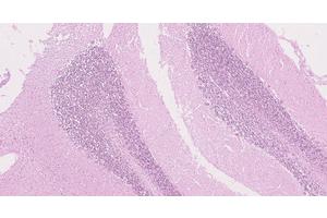 New Research Sheds Light on the Complexities of Cancer Predisposition