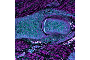 Flexible Joints: A Legacy from Our Ancient Jawed Fish Ancestors