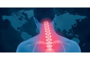 Global Research Reveals Elevated Levels of Depression and Anxiety Among Individuals Suffering from Chronic Pain