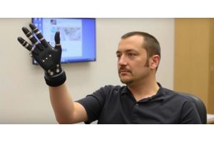 Mind-Driven Movement: Paralyzed Individual Controls Robotic Arm Using Thoughts