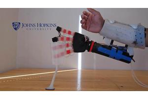 Touch with Confidence: Bionic Hand Mimics Human Sensation and Grasp