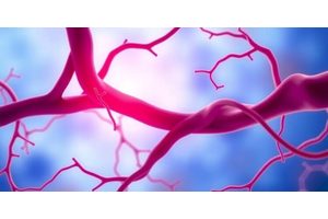 Prevalence of Undiagnosed and Undertreated Peripheral Vascular Disease in Women Calls for Increased Research Efforts