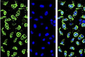 Revolutionary Drug Screening Technique Promises Solutions to Delivery and Efficacy Challenges