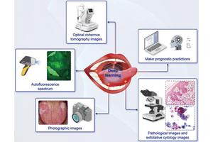 Revolutionizing Oral Health: Deep Learning Enhances Diagnosis and Prognosis of Potentially Malignant Disorders