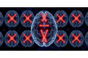 How the ‘Silent’ X Chromosome Enhances Brain Function in Aging Females