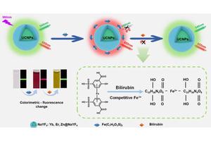 Revolutionizing Neonatal Care: Smartphones and Nanotechnology Facilitate Swift Jaundice Detection