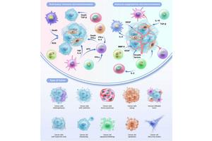 Exploring the Impact of Tumor-Infiltrating Immune Cells on Endometrial Carcinoma
