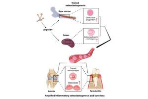 Innate Immune Training: A Catalyst for Increased Inflammatory Bone Loss