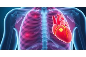Promising New Drug Offers Hope in Slowing Aortic Valve Disease Progression, Potentially Reducing Need for Surgeries