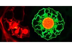 Peritoneal Adipose Stem Cell-Derived Extracellular Vesicles Enhance Ovarian Cancer Progression through EGFR-NF-κB Pathway Activation