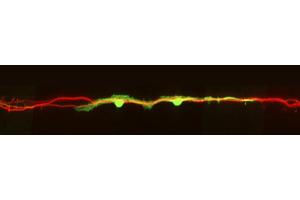 HDAC8 Inhibition Boosts Neuronal Regeneration and Enhances Sensory Function Recovery