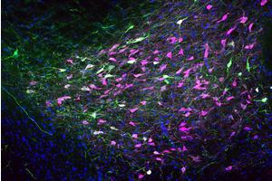 Rat Study Reveals Protective Role of Female Sex Hormone Against Opioid Misuse