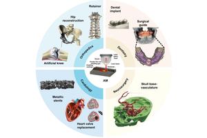 Advancements in Additive Manufacturing for Biomedical Metals in the Creation of Medical Implants