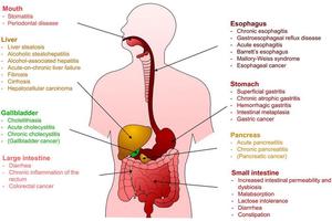 Impact of Ethanol Consumption on Digestive Health: A Scientific Overview