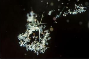 Marine Particles Play a Crucial Role in Nitrogen Fixation in the Global Ocean