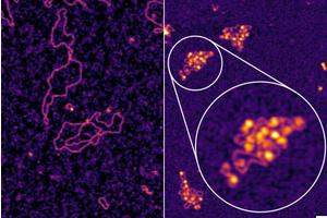 Exploring a Decade-Old Hepatitis B Enigma Unveils Promising New Treatment Possibilities