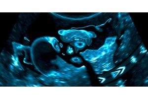 Advancing Medical Data Sharing: A Study on Synthetic Ultrasound Images of Breast Tissue