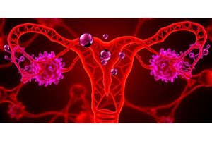 Mayo Clinic Researchers Uncover Promising New Immunotherapy Target for Ovarian Cancer