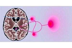 New Study Unveils Navtemadlin’s Role in Glioblastoma, Suggesting Enhanced Treatment Opportunities