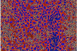 Powering Up Stem Cell Production: Enhancing Cell Numbers for Therapeutic Applications