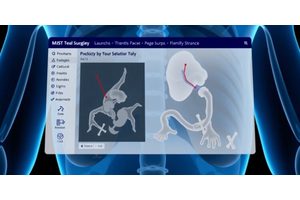 New Online Tool Launches to Aid Surgical Decision-Making in Gallbladder Cancer Cases