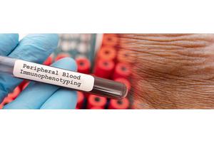 Groundbreaking Diagnostic Platform Unveils Novel Skin Disease, Reveal Dermatology Researchers
