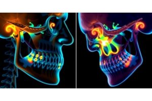 Revolutionary In Vivo Imaging Paves the Way for New Treatments and Hope for Chronic TMJ Pain Sufferers