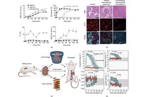 Breakthroughs in Organ Preservation: Transforming Transplantation Outcomes