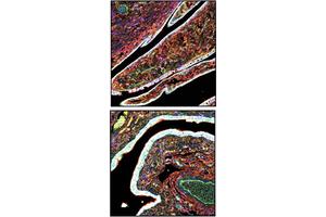 Pitt Research Unveils New Insights into the Origins of Ovarian Cancer