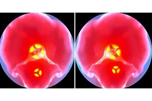 USC Research Reveals Link Between Inflammation Proteins and Bone Mineral Density Changes Over Time